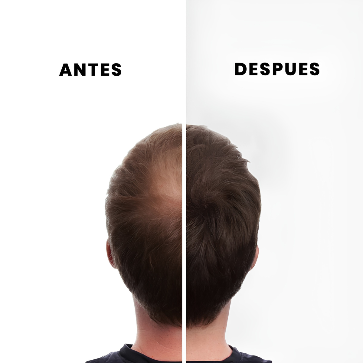 Nano Hair 100 grs Dos Recargas Castaño Oscuro